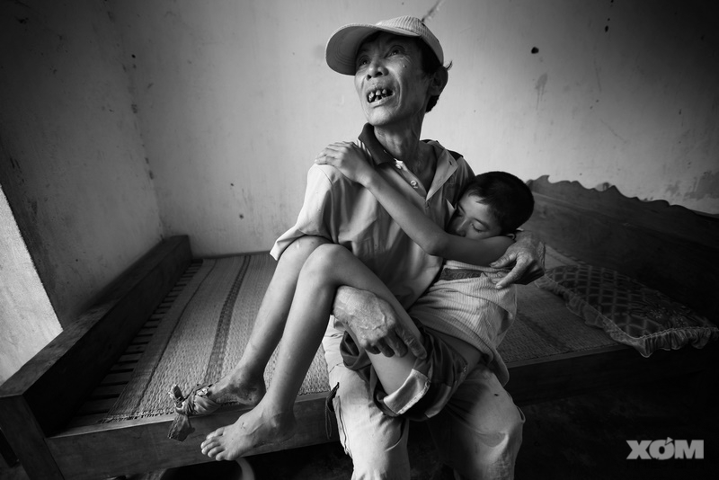 cấp cứu tuyến xã